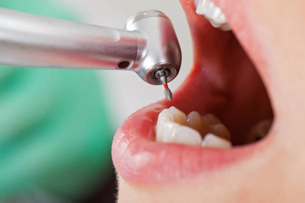 Best Emergency Denture Repair in Owenton, KY